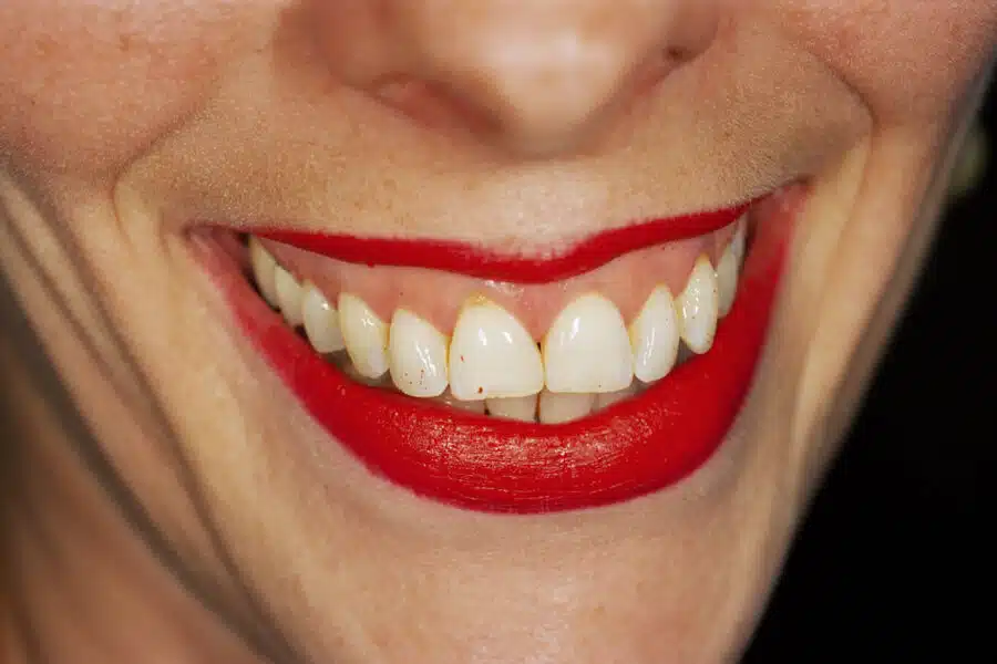 © Martin Parr / Magnum Photos